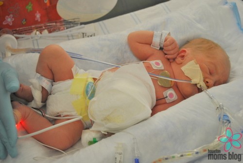 A baby hooked up to tubes and wires in a hospital. Logo: Houston moms Blog. 