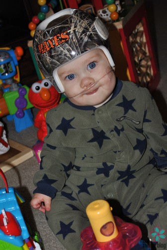 A baby with a special helmet and a nasal canula.  Logo: Houston moms Blog. 