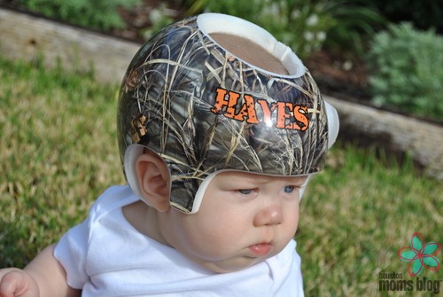 A baby wearing a special helmet. Logo: Houston moms blog. 