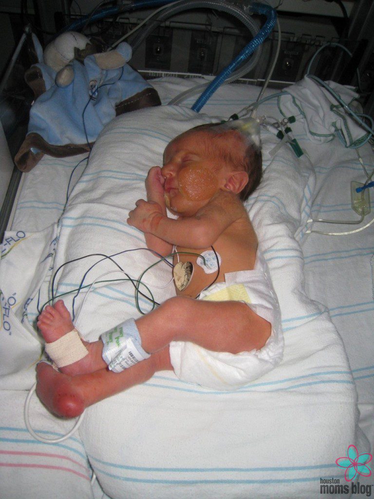 A baby in the NICU. Logo: Houston moms blog. 