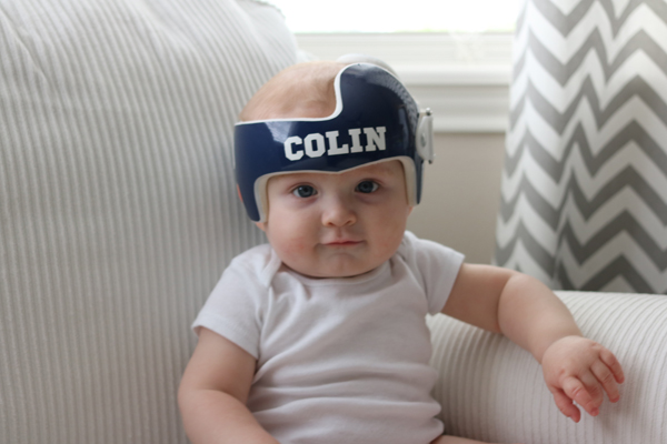 A photograph of a baby wearing a helmet.