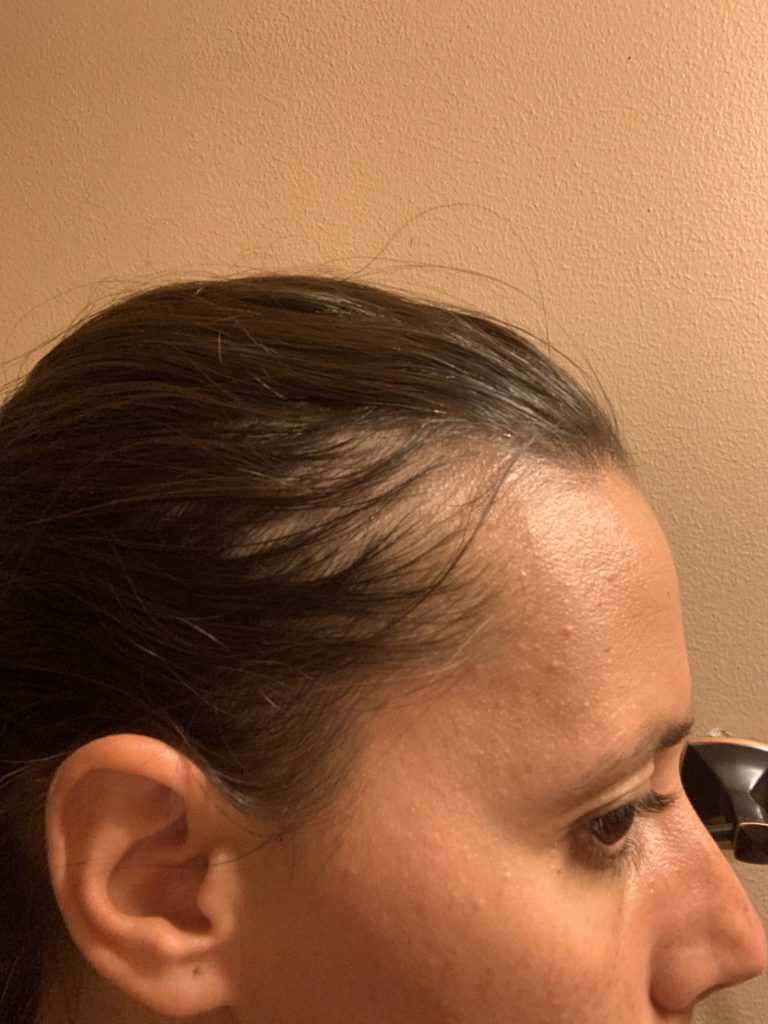 A woman with her hair pulled back. 