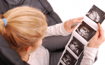 A woman looking at ultrasound images of a fetus.