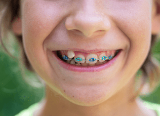 young boy with braces